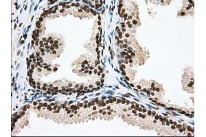 Immunohistochemistry (IHC) image for anti-Transforming, Acidic Coiled-Coil Containing Protein 3 (TACC3) antibody (ABIN1498096)