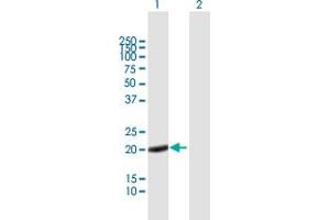 Western Blot analysis of CAPS expression in transfected 293T cell line by CAPS MaxPab polyclonal antibody. (Calcyphosine anticorps  (AA 1-189))