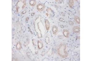 Immunohistochemistry of paraffin-embedded human kidney using ZNF91 antibody at dilution 1:100. (ZFP91 anticorps  (FITC))