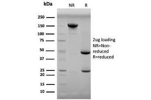 SDS-PAGE Analysis Purified Progesterone Mouse Monoclonal Antibody (6-5E-3F). (Progesterone anticorps)