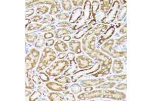 Immunohistochemistry of paraffin-embedded mouse kidney using BMPR1B Rabbit pAb (ABIN3022719, ABIN3022720, ABIN3022721, ABIN1512645 and ABIN6219169) at dilution of 1:350 (40x lens).