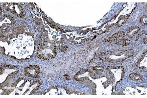IHC analysis of MCM6 using anti-MCM6 antibody (ABIN7600036). (MCM6 anticorps  (AA 14-821))