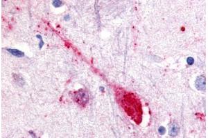 Anti-GPR85 antibody  ABIN1048886 IHC staining of human putamen, neuron. (GPR85 anticorps  (Extracellular Domain))
