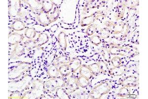 Formalin-fixed and paraffin embedded mouse kidney tissue labeled with Anti-Cathepsin H Polyclonal Antibody, Unconjugated  at 1:200 followed by conjugation to the secondary antibody, (SP-0023), and DAB staining (Cathepsin H anticorps  (AA 71-170))