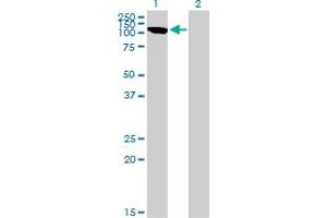 Western Blot analysis of CLCN2 expression in transfected 293T cell line by CLCN2 monoclonal antibody (M01), clone 3E1.