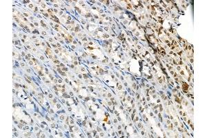 ABIN6256762 and ABIN6267084 at 1/100 staining Rat stomach tissue by IHC-P.
