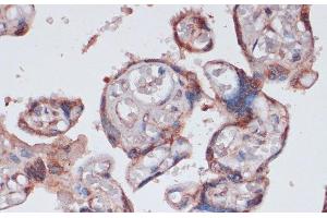 Immunohistochemistry of paraffin-embedded Human placenta using RPS13 Polyclonal Antibody at dilution of 1:100 (40x lens).