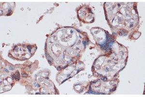 Immunohistochemistry of paraffin-embedded Human placenta using RPS13 Polyclonal Antibody at dilution of 1:100 (40x lens). (RPS13 anticorps)