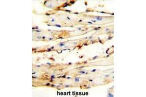 CRCT1 antibody (N-term) immunohistochemistry analysis in formalin fixed and paraffin embedded mouse heart tissue followed by peroxidase conjugation of the secondary antibody and DAB staining. (CRCT1 anticorps  (N-Term))