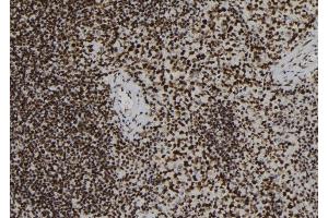 anti-FYN-Binding Protein (FYB) antibody