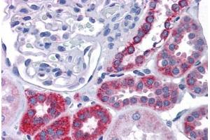 Human Kidney: Formalin-Fixed, Paraffin-Embedded (FFPE)