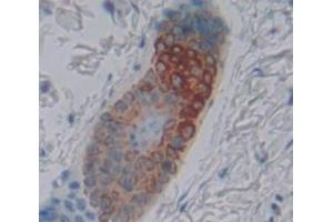 Used in DAB staining on fromalin fixed paraffin- embedded Kidney tissue (Keratin 25 anticorps  (AA 1-446))