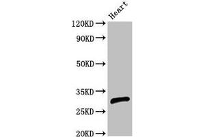 Western Blot Positive WB detected in: Rat heart tissue All lanes: CEBPE antibody at 2. (CEBPE anticorps  (AA 1-200))
