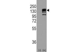 Western blot analysis of CDH1/ E Cadherin antibody and 293 cell lysate (2 ug/lane) either nontransfected (Lane 1) or transiently transfected with the CDH1 gene (2).