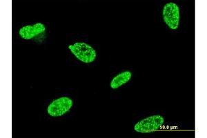 Immunofluorescence of monoclonal antibody to TP53RK on HeLa cell. (TP53RK anticorps  (AA 154-253))