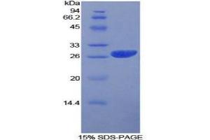 SDS-PAGE analysis of Human Prion Protein. (PRNP Protéine)