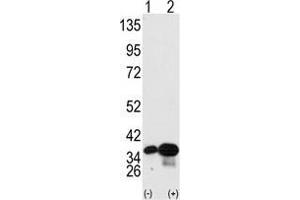 Western blot analysis of PHB2 (arrow) using PHB2 Antibody . (Prohibitin 2 anticorps  (Tyr248))