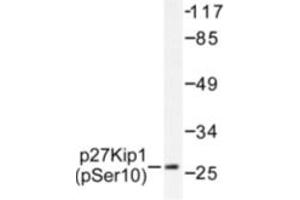 Image no. 1 for anti-Cyclin-Dependent Kinase Inhibitor 1B (p27, Kip1) (CDKN1B) (pSer10) antibody (ABIN318090) (CDKN1B anticorps  (pSer10))