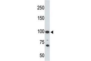 Western blot testing of Angiotensin-converting enzyme 2 antibody and 293 cell lysate.