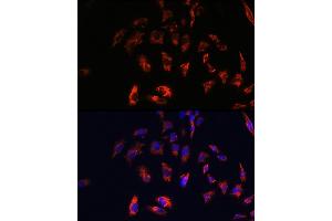 Immunofluorescence analysis of C6 cells using CD74 antibody (ABIN6128421, ABIN6138228, ABIN6138230 and ABIN6221316) at dilution of 1:100.