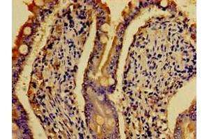 Immunohistochemistry of paraffin-embedded human small intestine tissue using ABIN7142640 at dilution of 1:100