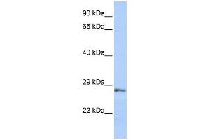 SFRP2 antibody used at 1 ug/ml to detect target protein.