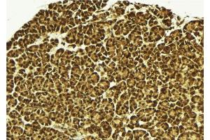 ABIN6279525 at 1/100 staining Mouse pancreas tissue by IHC-P. (MED15 anticorps  (C-Term))
