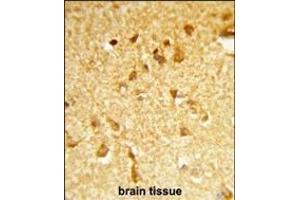 Formalin-fixed and paraffin-embedded human brain tissue reacted with DDX17 Antibody (N-term), which was peroxidase-conjugated to the secondary antibody, followed by DAB staining.