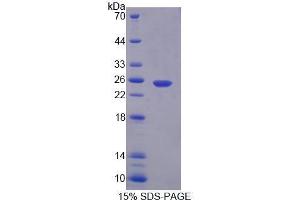Image no. 1 for Calpain 7 (CAPN7) (AA 1-157) protein (His tag) (ABIN6239686)