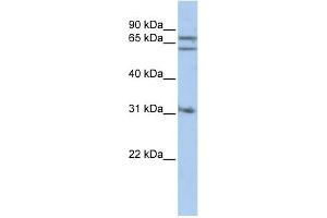 WB Suggested Anti-GPHN Antibody Titration: 0. (Gephyrin anticorps  (Middle Region))