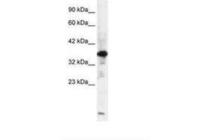 Image no. 2 for anti-Zinc Finger Protein-Like 1 (ZFPL1) (AA 101-150) antibody (ABIN6735842) (ZFPL1 anticorps  (AA 101-150))