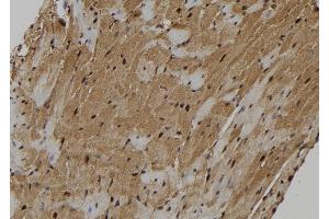 ABIN6273130 at 1/100 staining Mouse heart tissue by IHC-P. (KIF18A anticorps  (Internal Region))