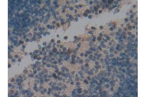 IHC-P analysis of Mouse Spleen Tissue, with DAB staining. (Ki-67 anticorps  (AA 2386-2674))