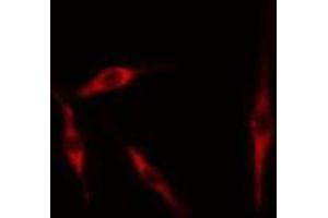 ABIN6276729 staining 293 cells by IF/ICC. (Tryptophan Hydroxylase 1 anticorps  (Internal Region))