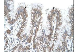 Image no. 1 for anti-arginine/serine-Rich Coiled-Coil 2 (RSRC2) (AA 363-412) antibody (ABIN321837) (RSRC2 anticorps  (AA 363-412))