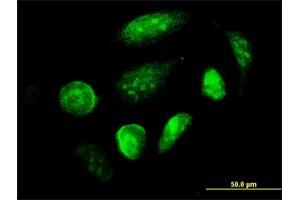 Immunofluorescence of monoclonal antibody to GCM1 on HeLa cell. (GCM1 anticorps  (AA 108-166))