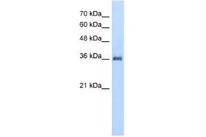 WB Suggested Anti-PPAP2A Antibody Titration:  5. (PPAP2A anticorps  (N-Term))