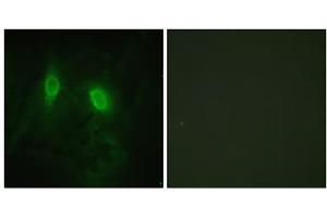 Immunofluorescence analysis of HeLa cells, using IKK- gamma (epitope around residue 85) antibody. (IKBKG anticorps  (Ser85))