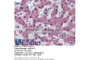 Immunohistochemistry (IHC) image for anti-Transferrin Receptor 2 (TFR2) (N-Term) antibody (ABIN2782221)