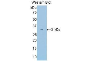 Western Blotting (WB) image for anti-Pyruvate Dehydrogenase beta (PDHB) (AA 65-336) antibody (ABIN1860164)