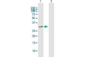 Western Blot analysis of CENPK expression in transfected 293T cell line by CENPK MaxPab polyclonal antibody.