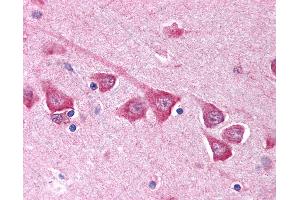 Anti-SCN3B antibody IHC of human brain, cortex.