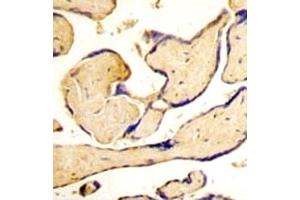 IHC analysis of FFPE human placenta tissue stained with EphA3 antibody
