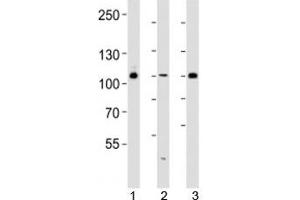 Western blot analysis of lysate from 293, HUVEC, T47D cell line (left to right) using GAB1 antibody diluted at 1:1000 for each lane. (GAB1 anticorps  (AA 250-285))