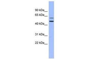 Image no. 1 for anti-Dyskeratosis Congenita 1, Dyskerin (DKC1) (AA 35-84) antibody (ABIN6742970) (DKC1 anticorps  (AA 35-84))