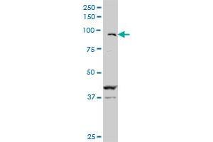 ZFHX1B monoclonal antibody (M02), clone 2H5.