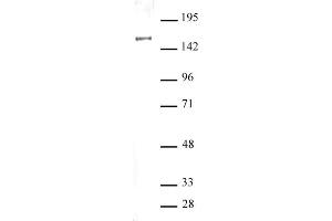 SIN3A antibody (pAb) tested by Western blot. (SIN3A anticorps  (N-Term))
