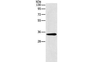 Western Blot analysis of Mouse liver tissue using GNMT Polyclonal Antibody at dilution of 1:200 (GNMT anticorps)