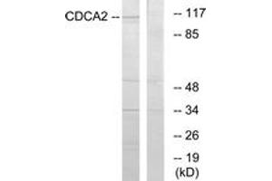 Western blot analysis of extracts from 293 cells, using CDCA2 Antibody. (CDCA2 anticorps  (AA 511-560))