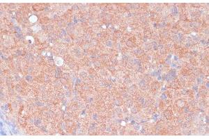 Immunohistochemistry of paraffin-embedded Rat ovary using LRP1 Polyclonal Antibody at dilution of 1:100 (40x lens). (LRP1 anticorps)